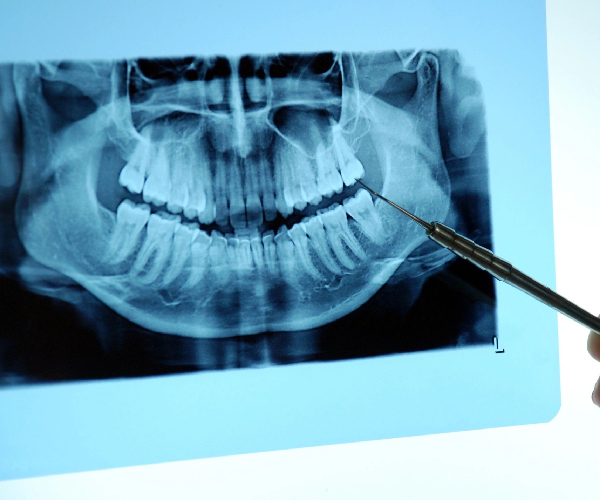 Raritan Bay Oral & Facial Surgery